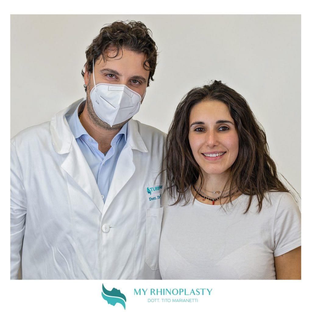 Rinoplastica post intervento
