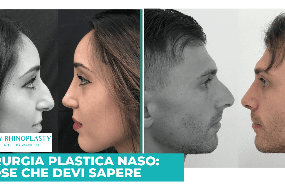 Chirurgia plastica naso