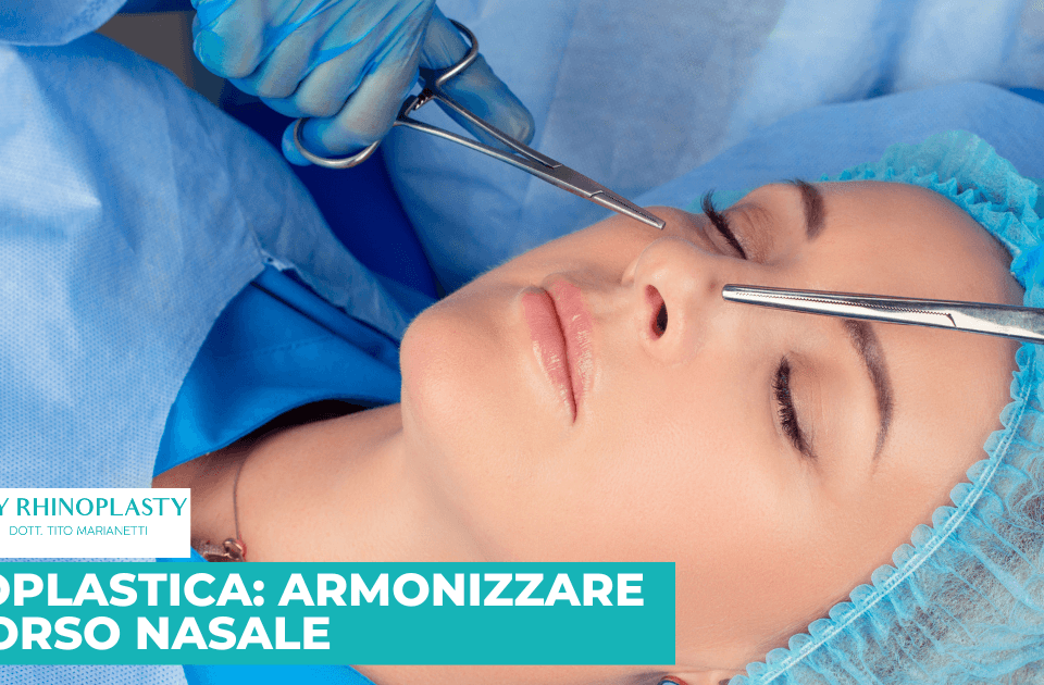 Rinoplastica armonizzare il dorso nasale