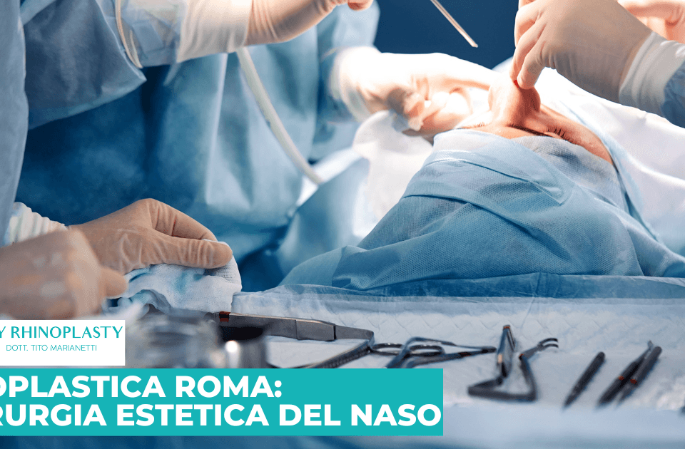 rinoplastica roma