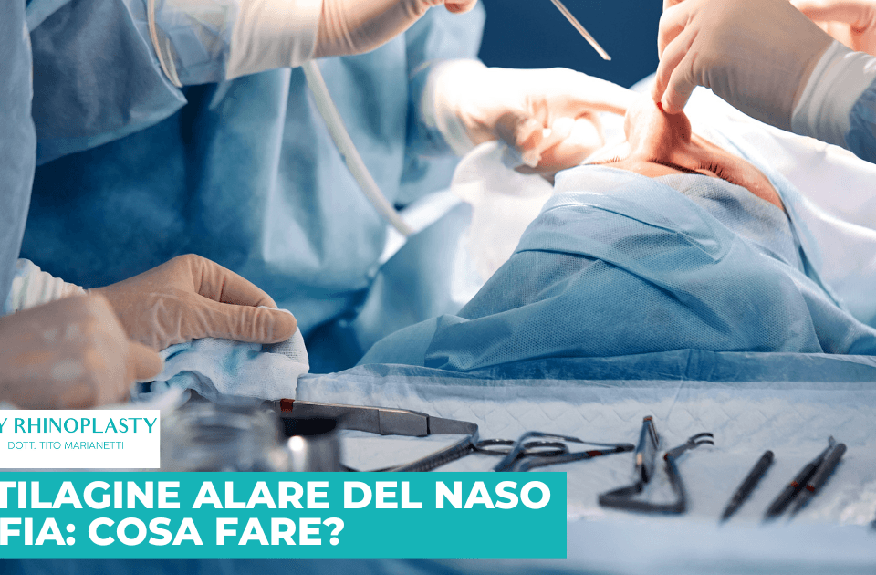 Cartilagine Alare naso gonfia