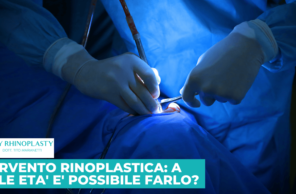 Intervento rinoplastica