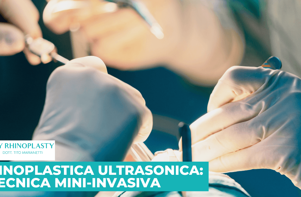 Rinoplastica Ultrasonica