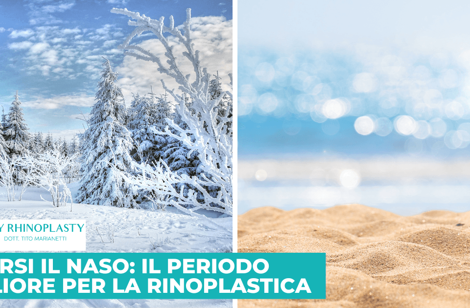 rifarsi il naso il periodo migliore per la rinoplastica