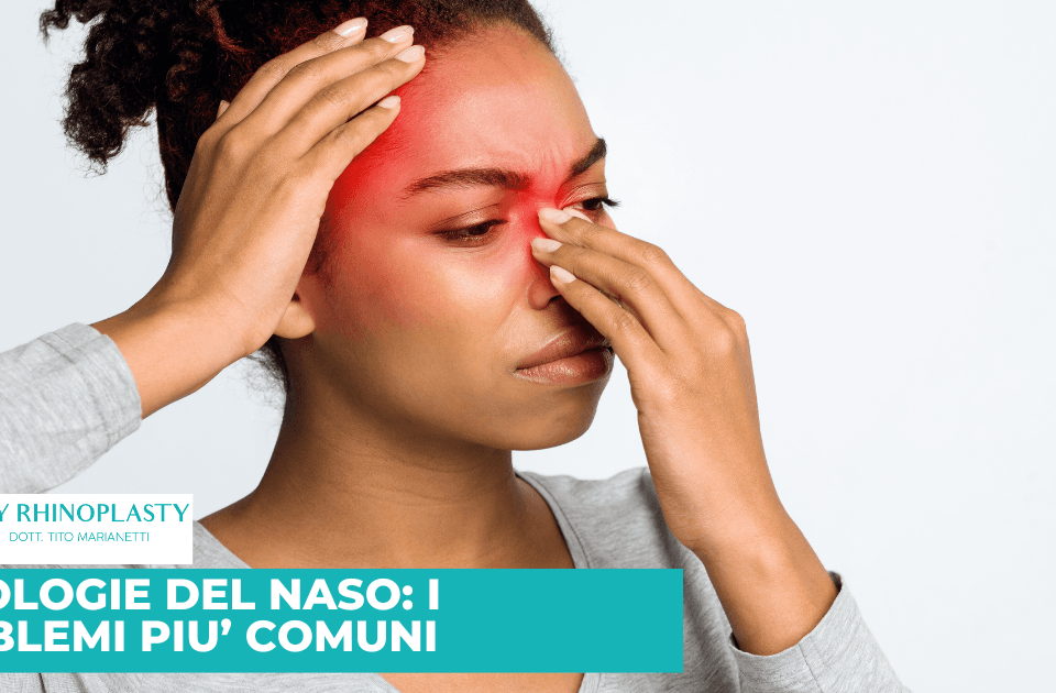 Le patologie del naso