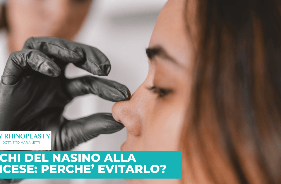 Nasino alla francese