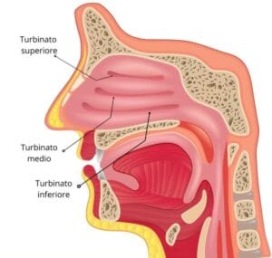 Ipertrofici Significato