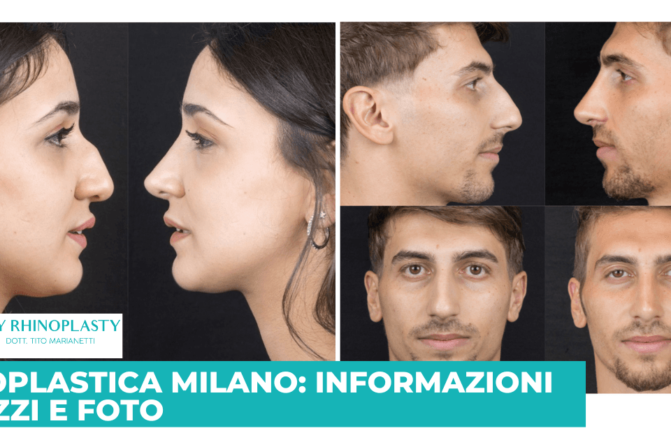 RInoplastica Milano