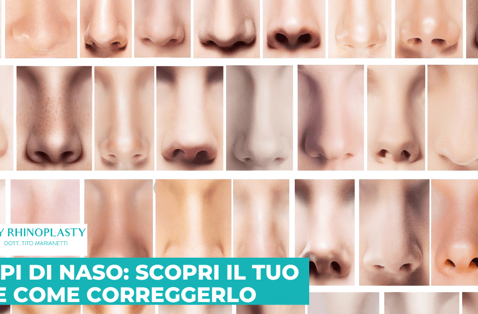 14 tipi di naso
