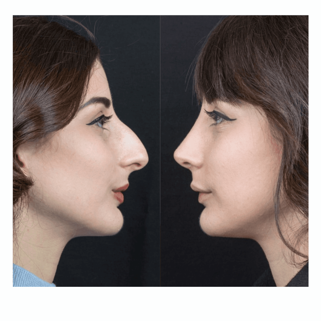 Forme di naso e personalità