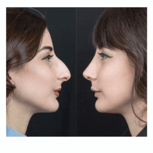 Forme di naso e personalità