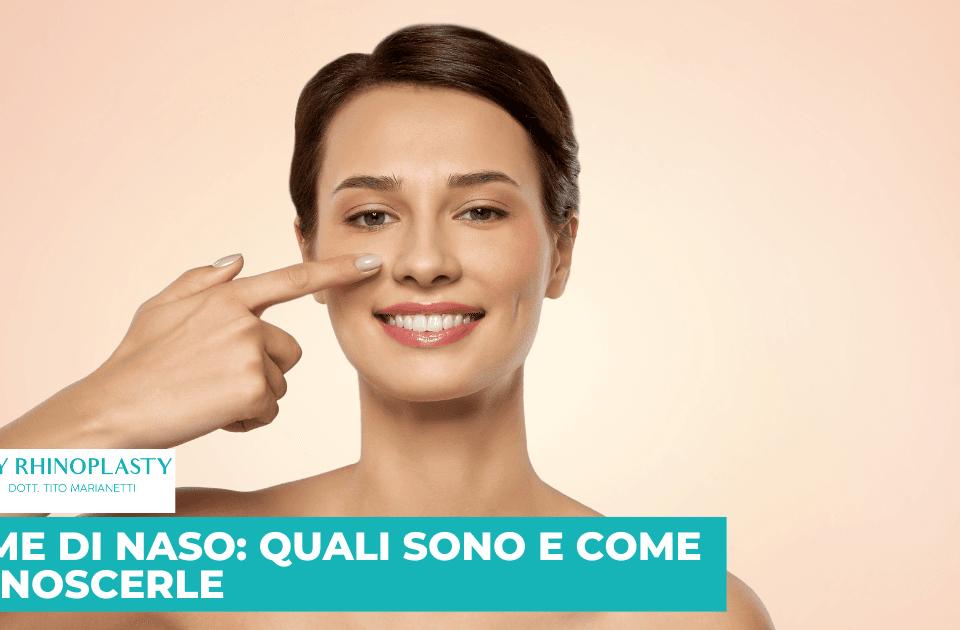 Forme di naso