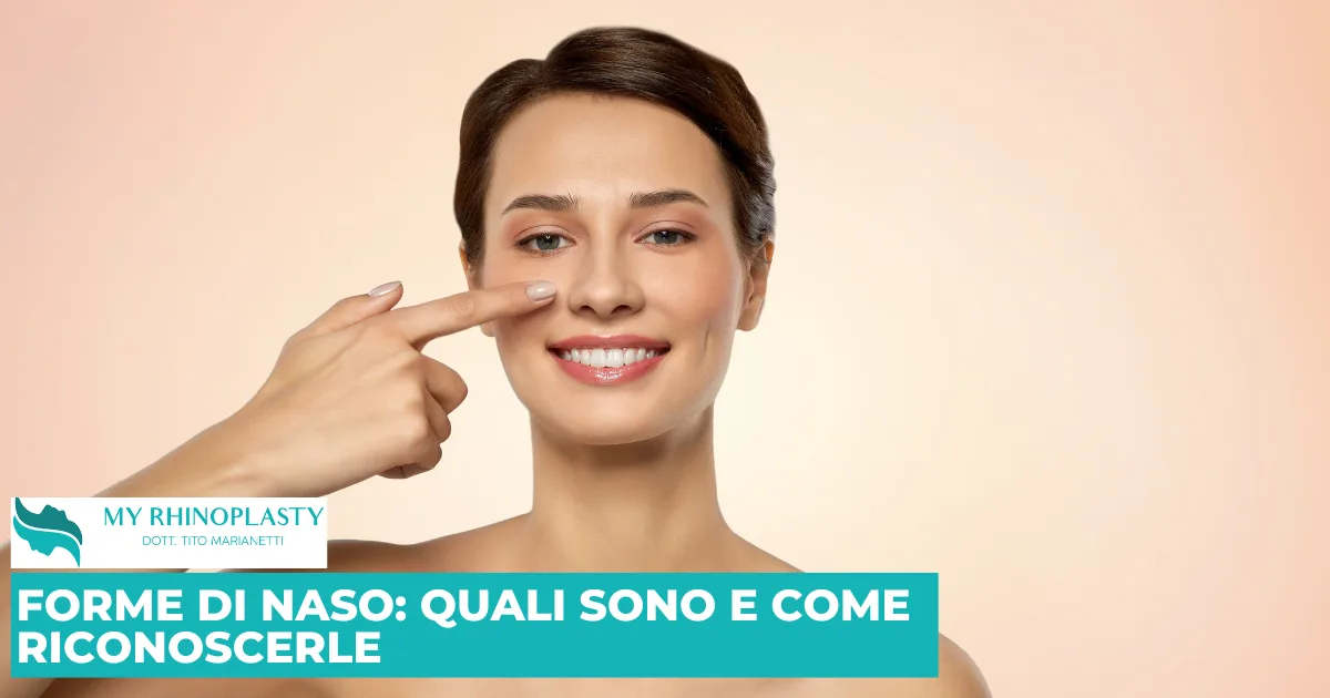 Forme di naso