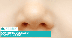 Naso
