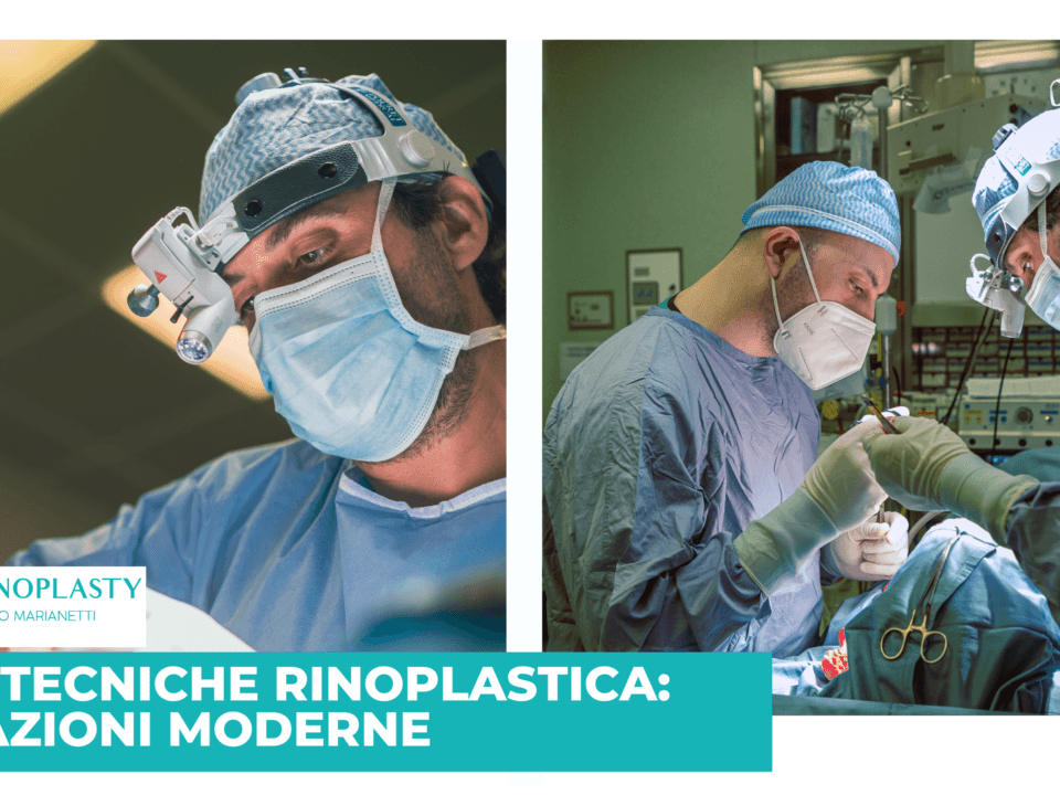 Nuove Tecniche Rinoplastica Cover