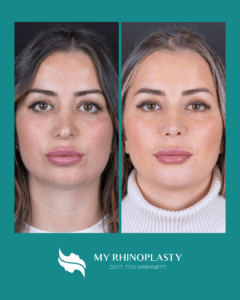 Tito Marianetti Recensioni