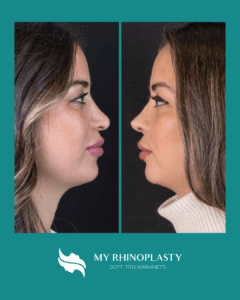 Tito Marianetti Testimonianze