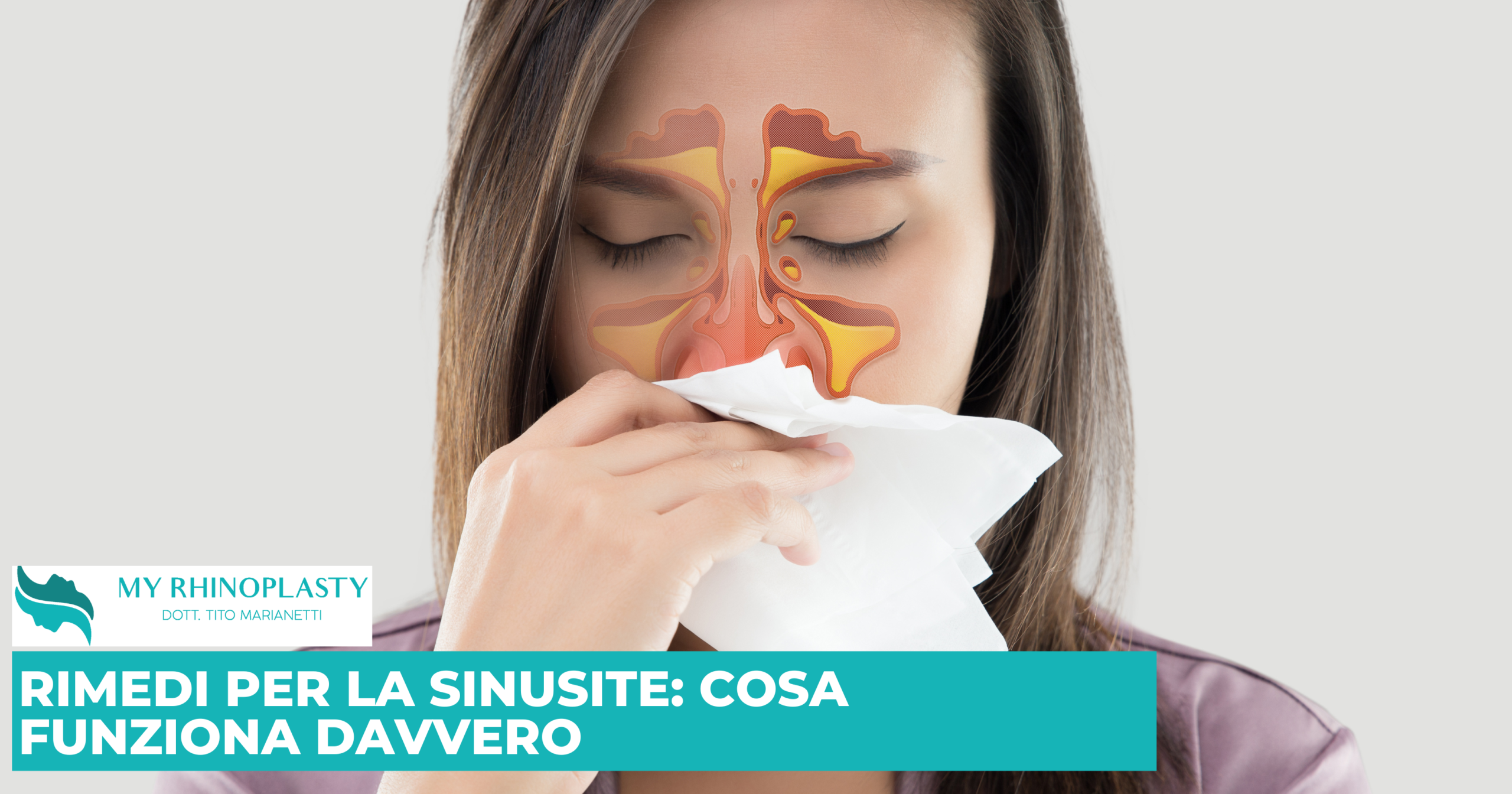 Rimedi per la sinusite