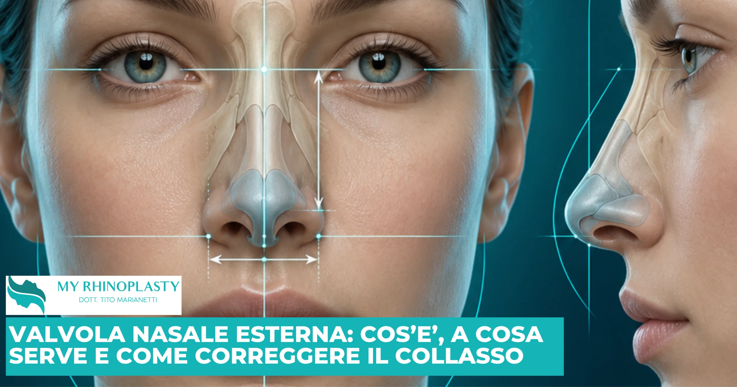 Valvola nasale esterna